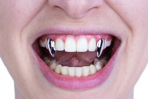 ScareCrow Vampire Fangs - Small - Chrome