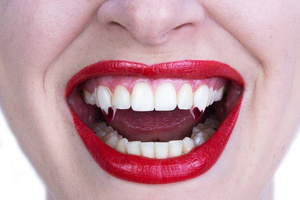 ScareCrow Vampire Fangs - Small - Blood Tips