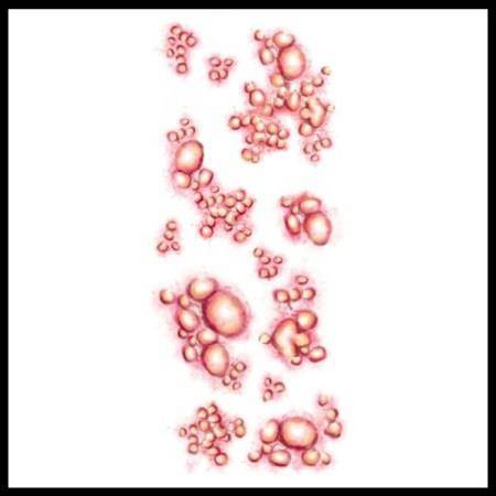 Diseased Tattoo - tatuaż tymczasowy